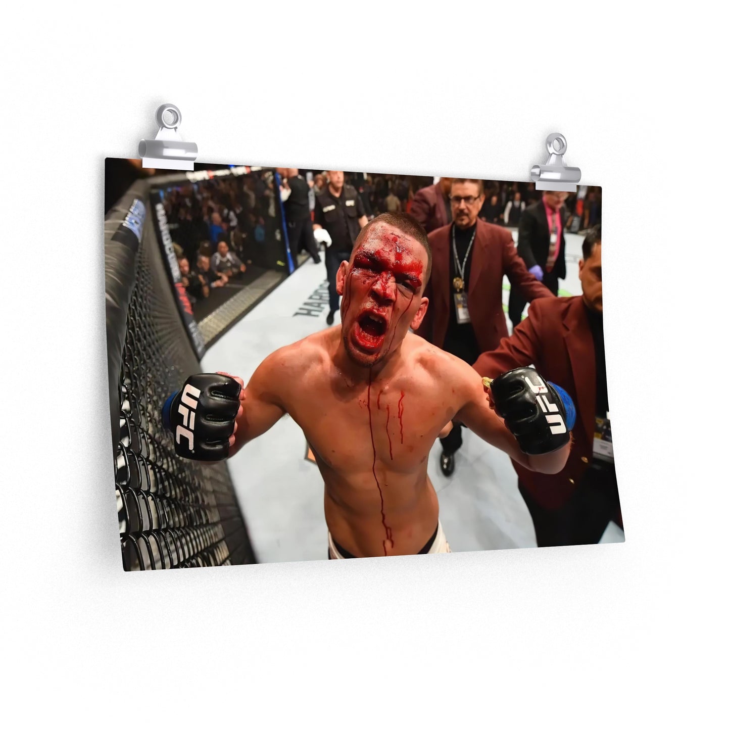 Nate Diaz Flexing Bleeding At Camera After Beating Conor McGregor Poster