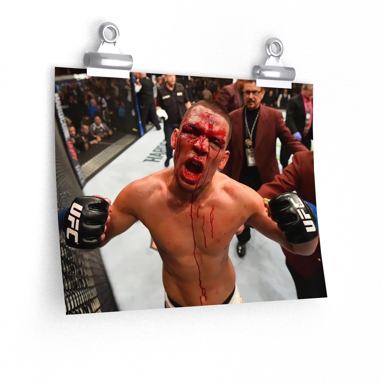 Nate Diaz Flexing Bleeding At Camera After Beating Conor McGregor Poster